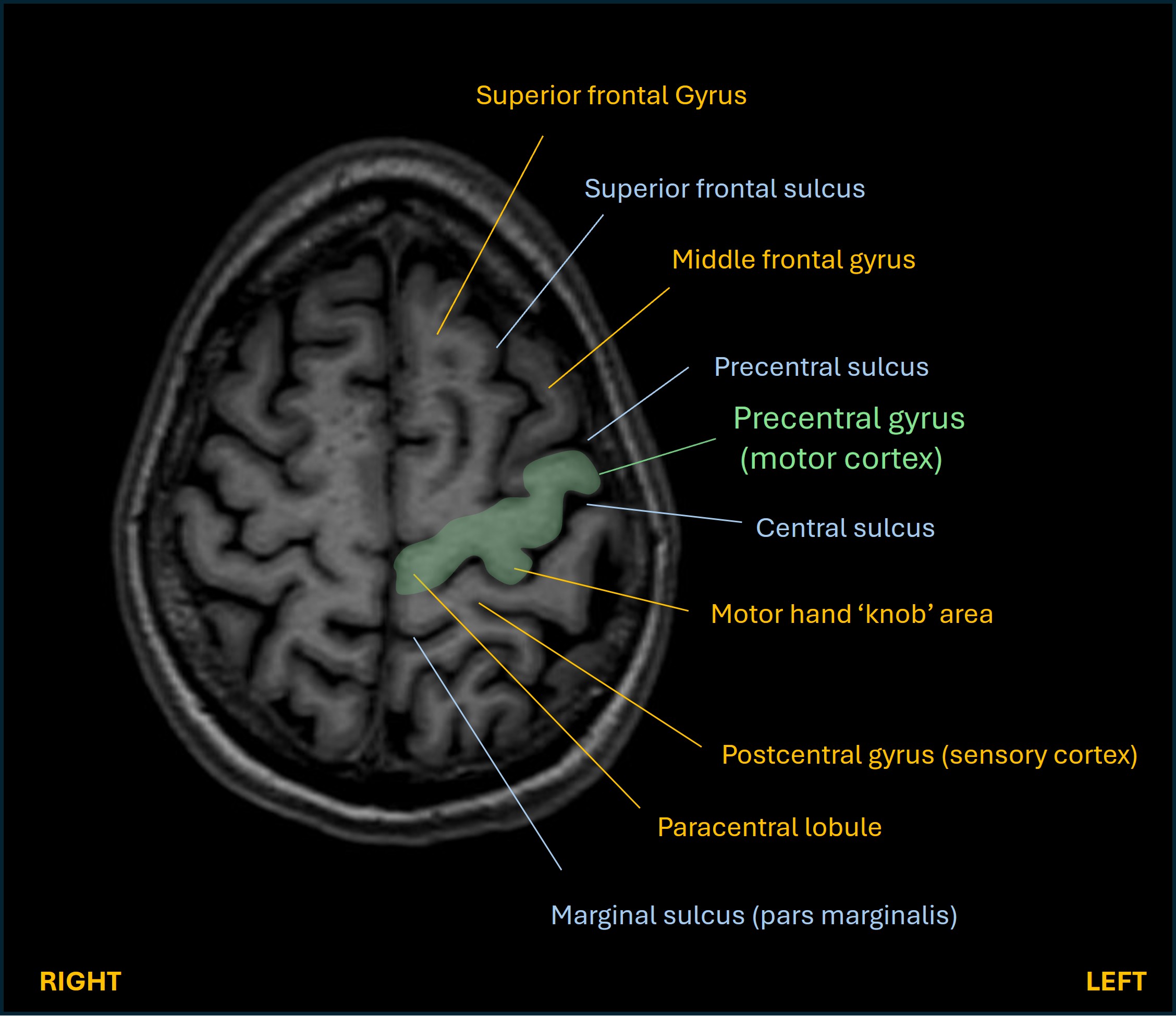 Motor cortex