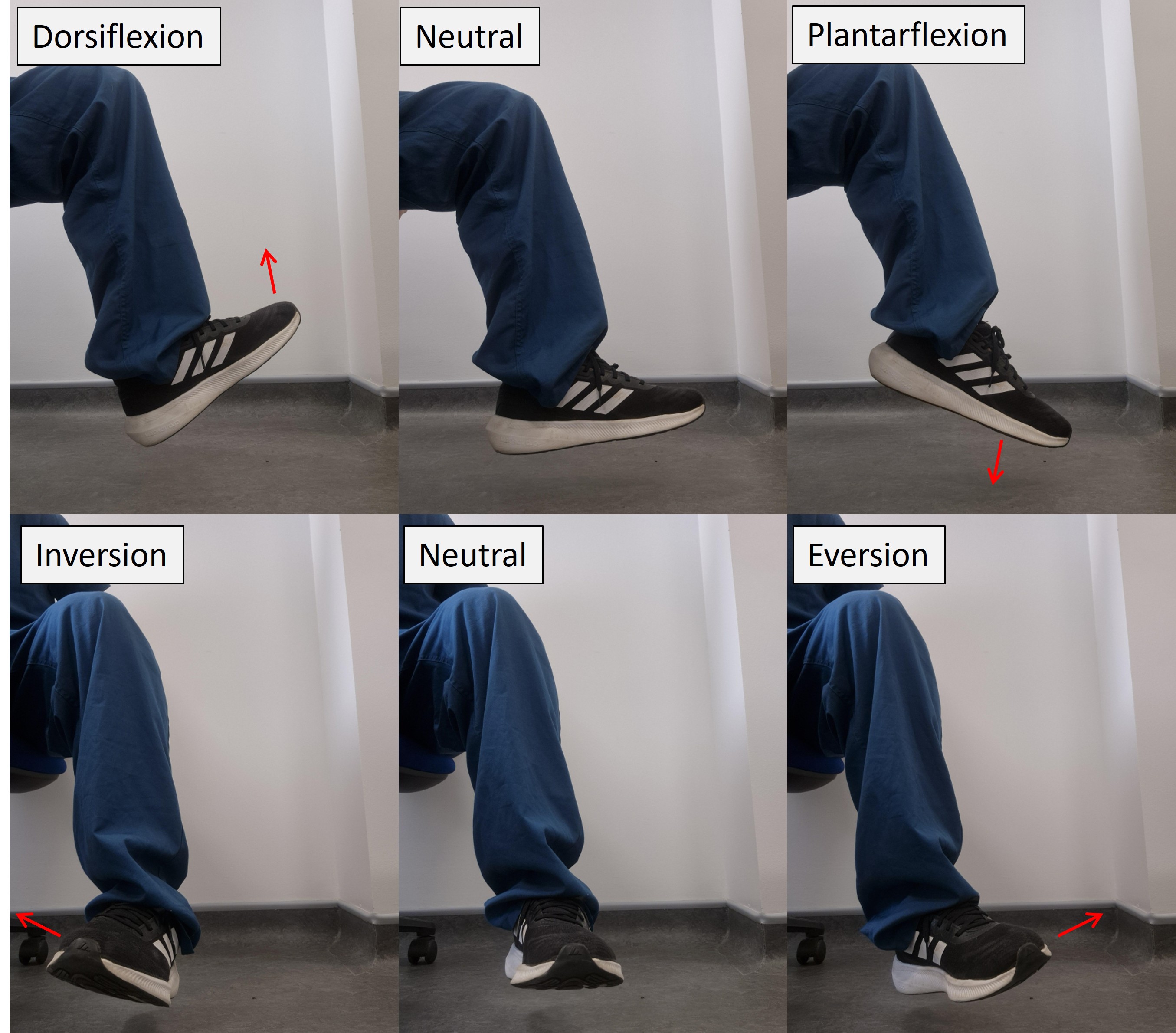 Common peroneal nerve