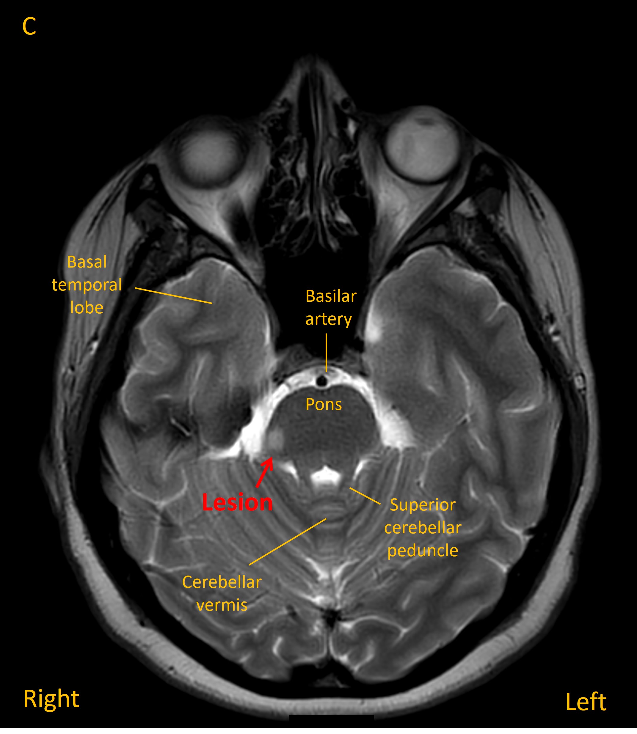 MRI 3