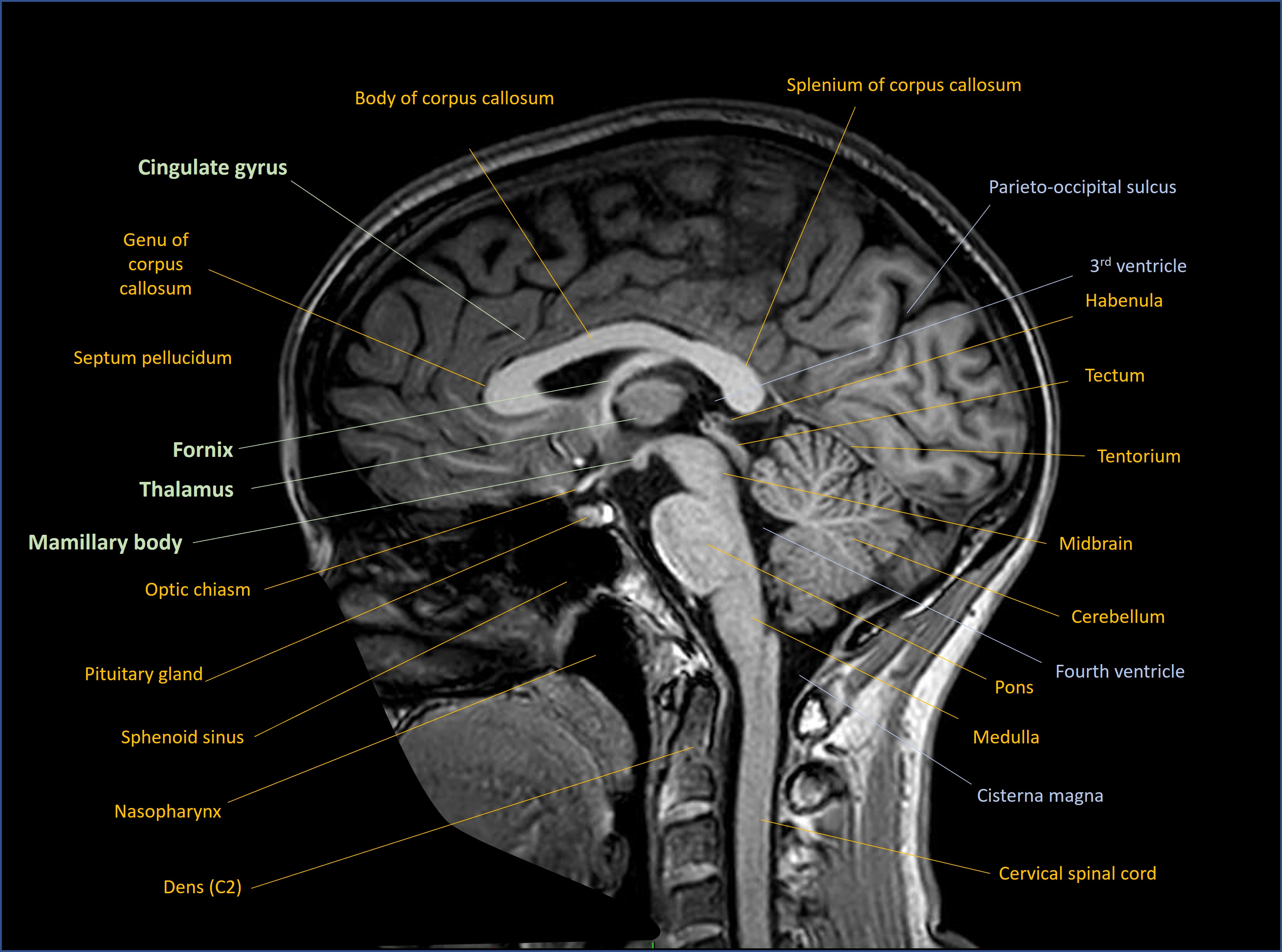 Sagittal