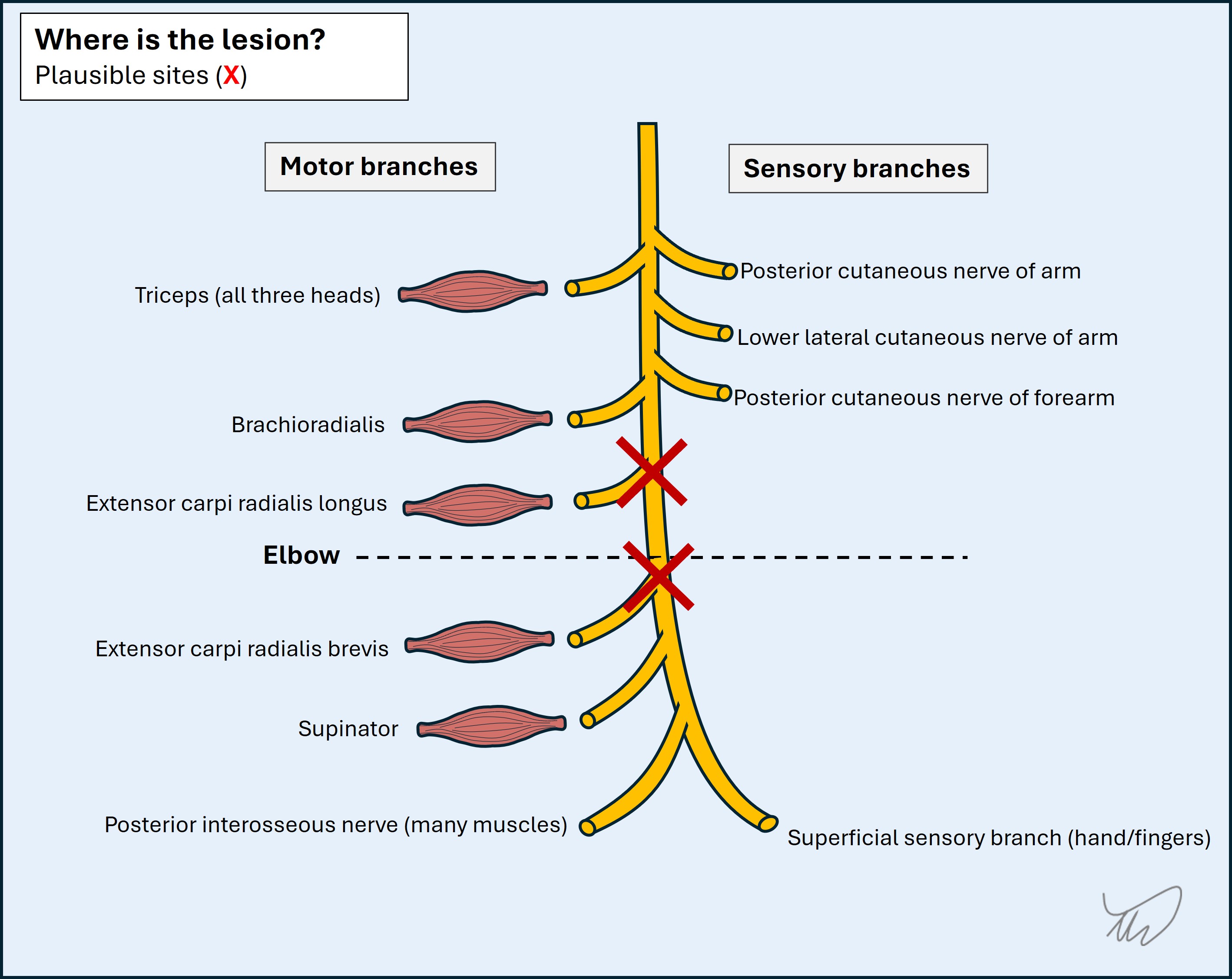 Radial nerve