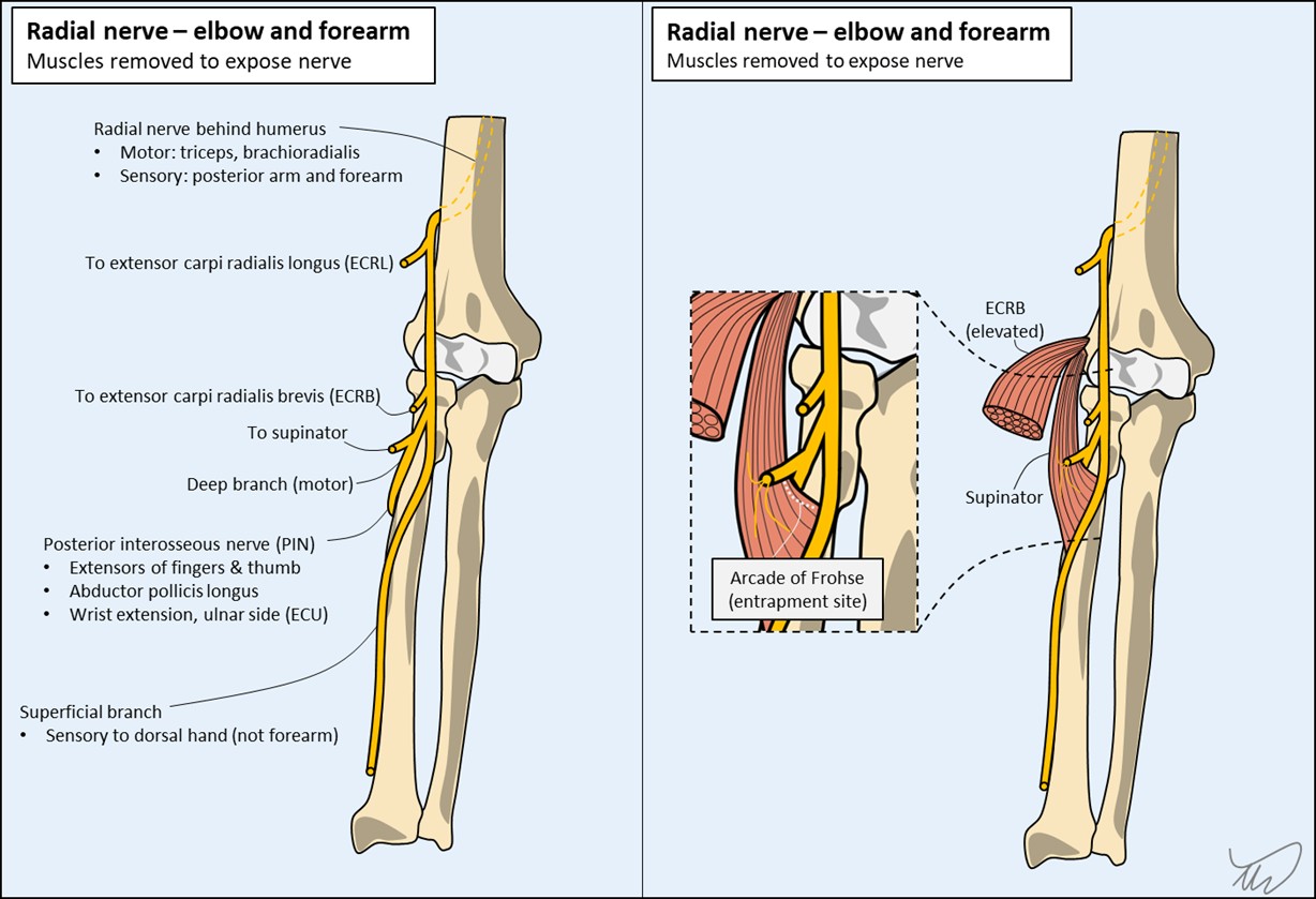 Radial nerve